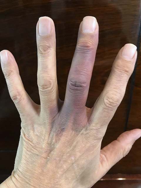 The Finger 